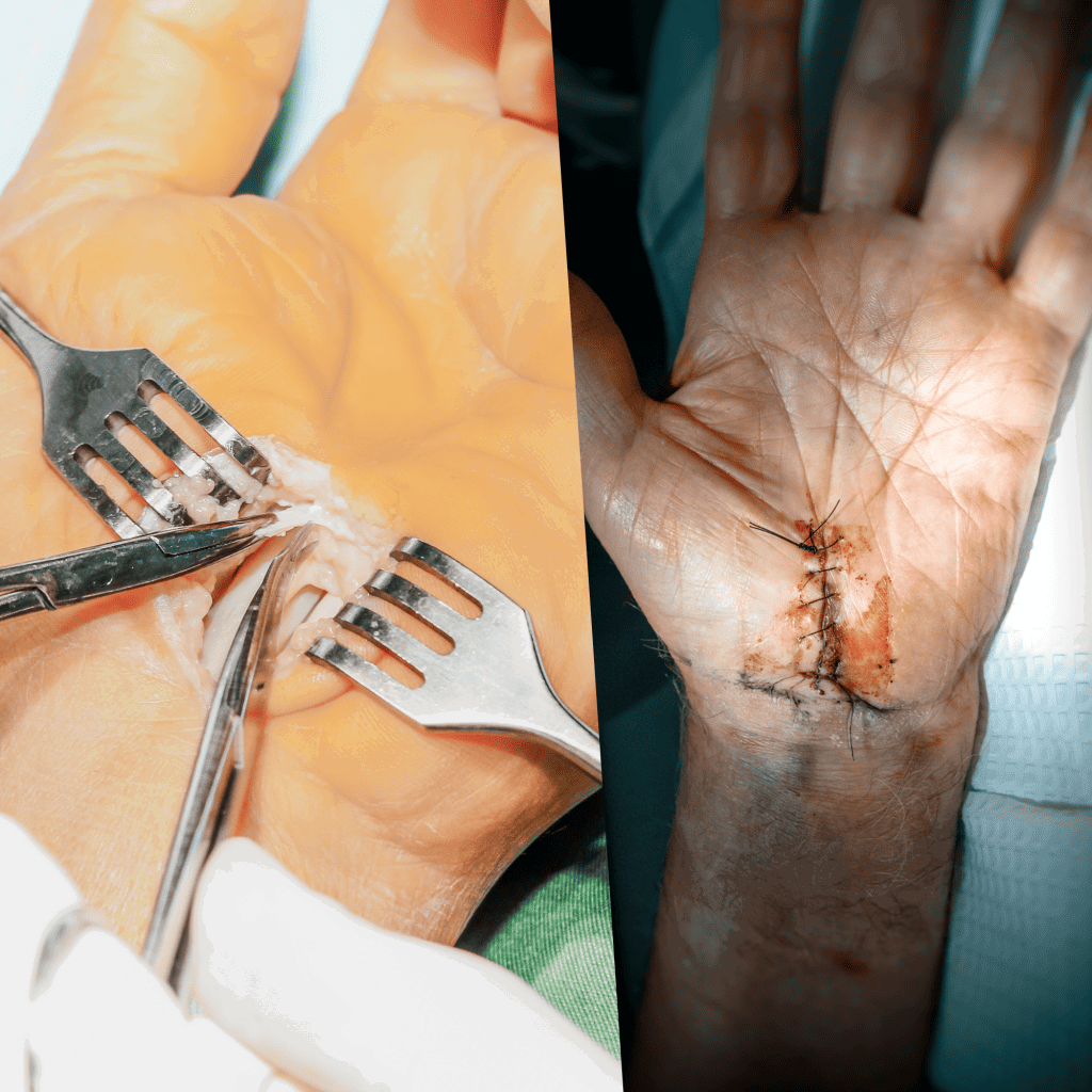 Surgery