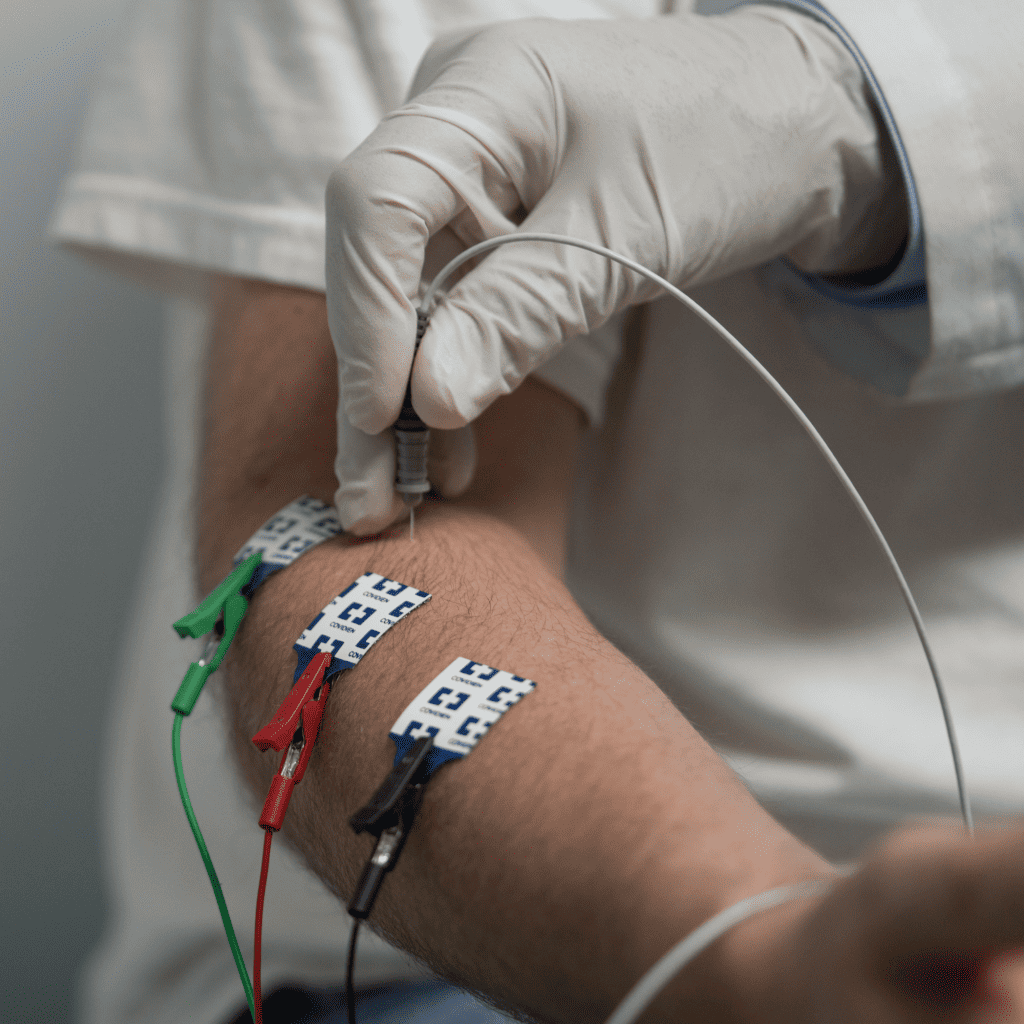Nerve-Muscle Activity