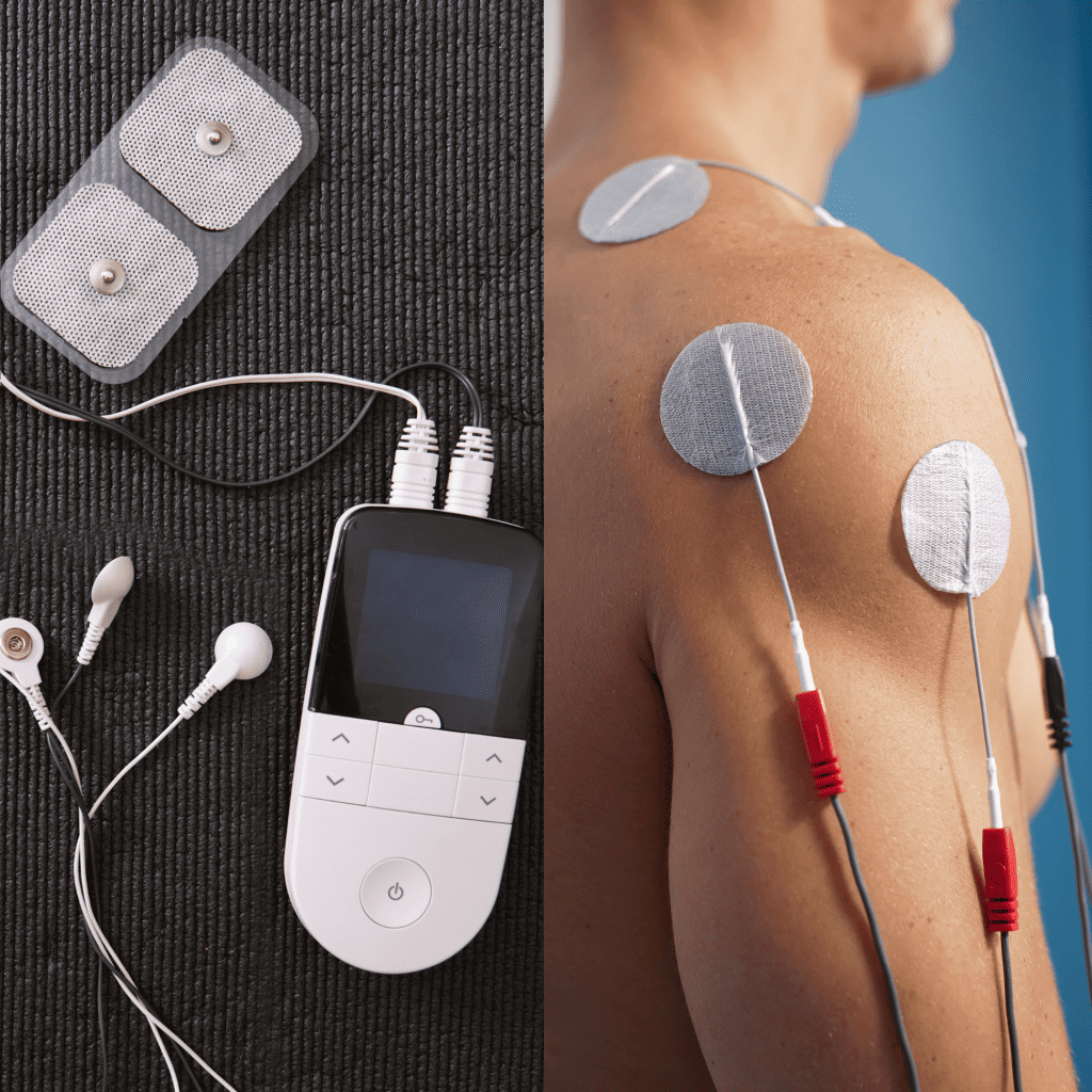 Nerve Stimulation