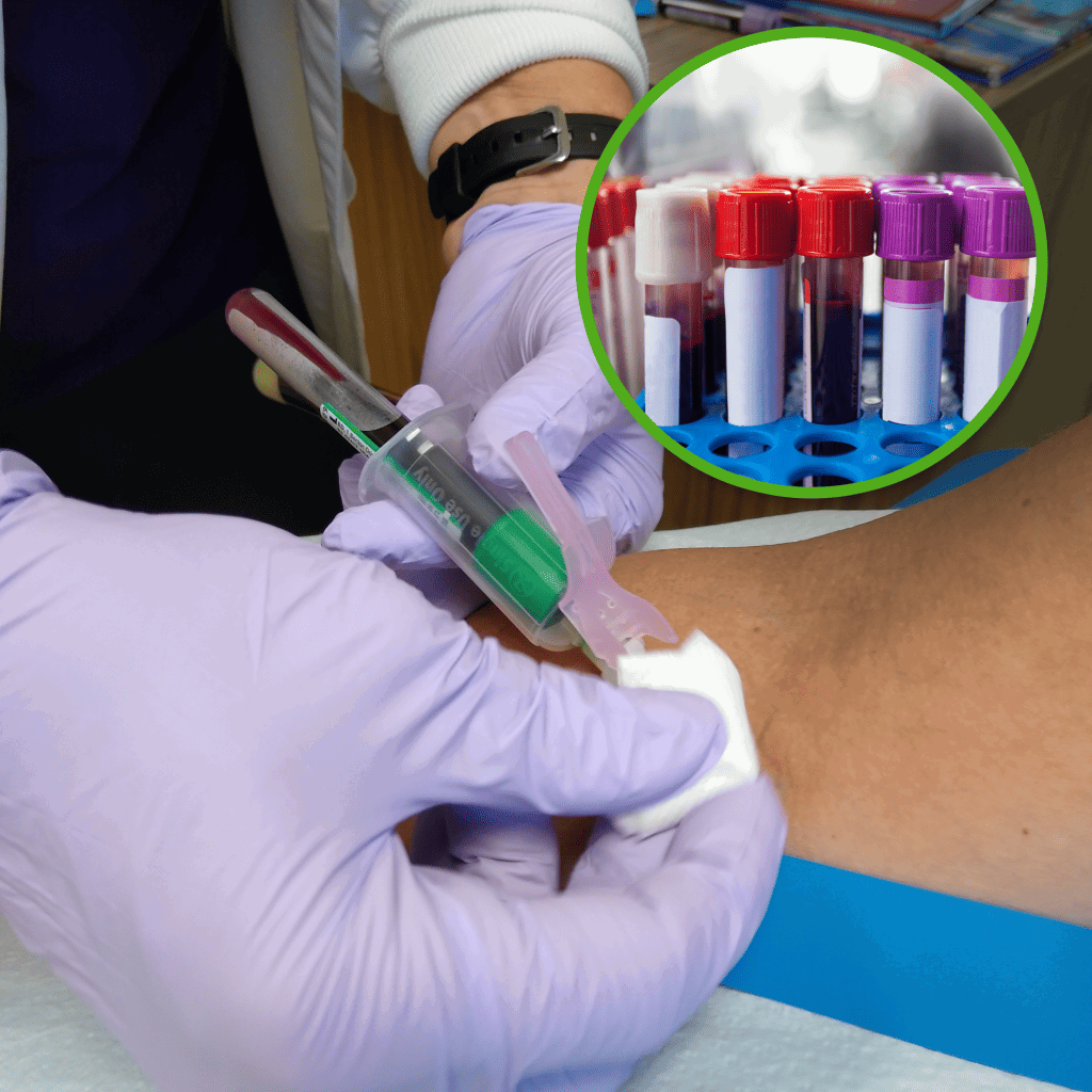 Blood Tests