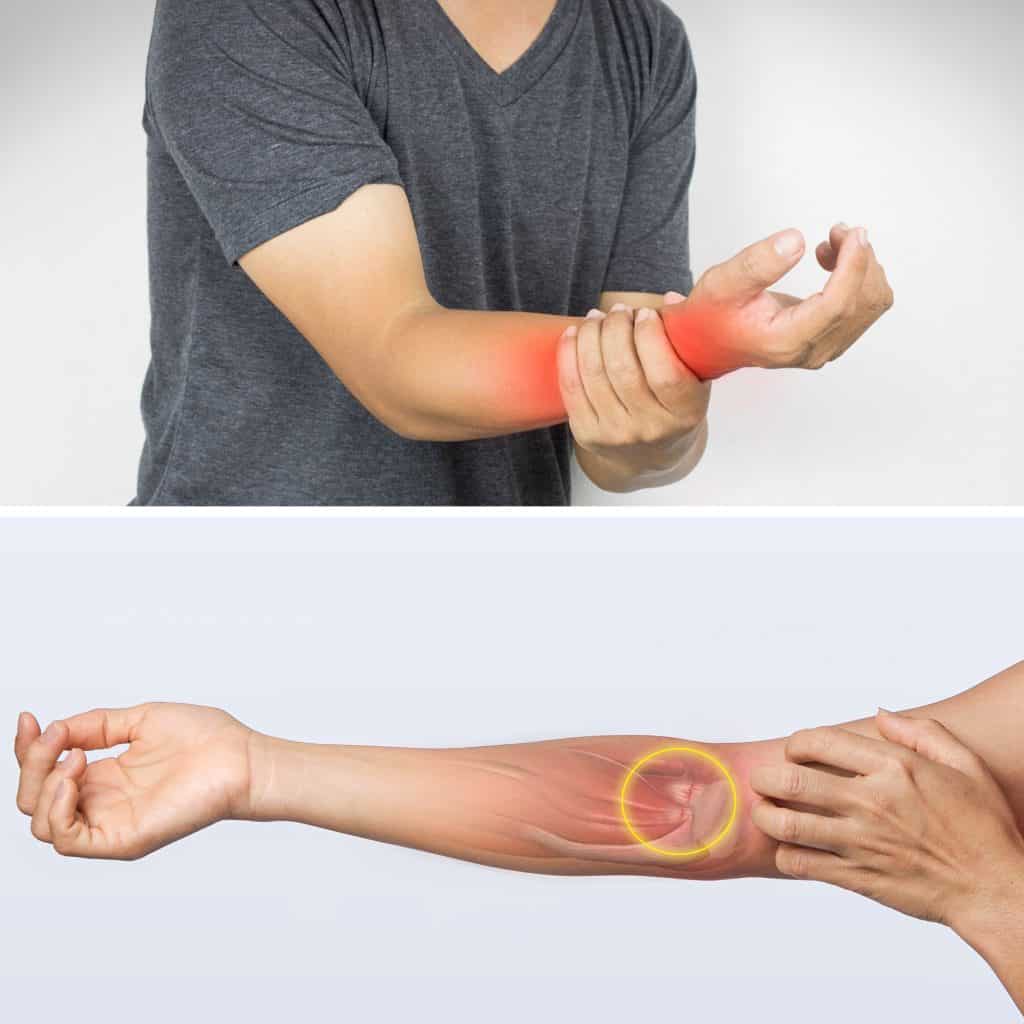 What are the common causes of forearm pain