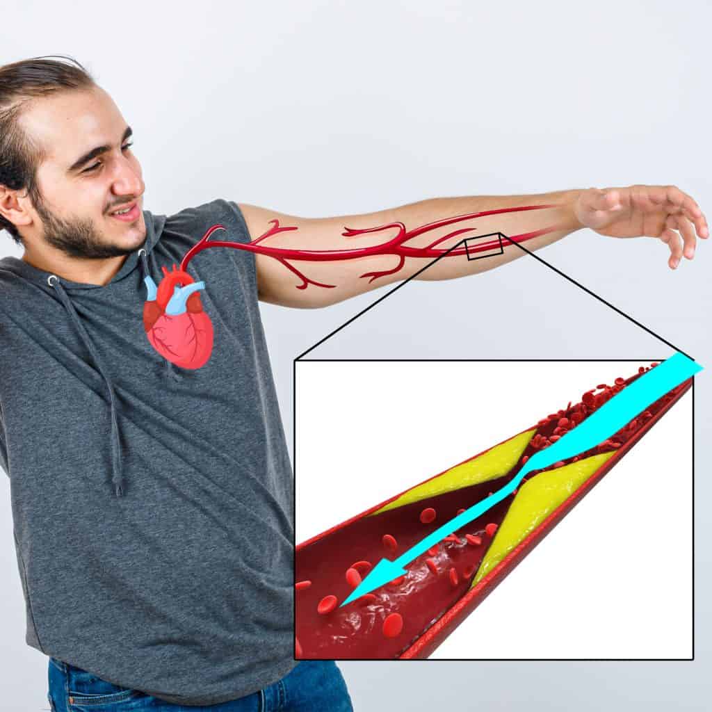 Problems with Blood Flow