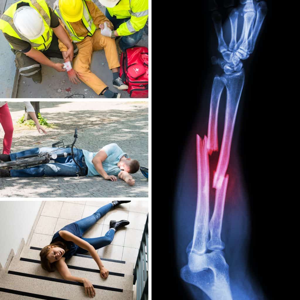 Injury and Trauma