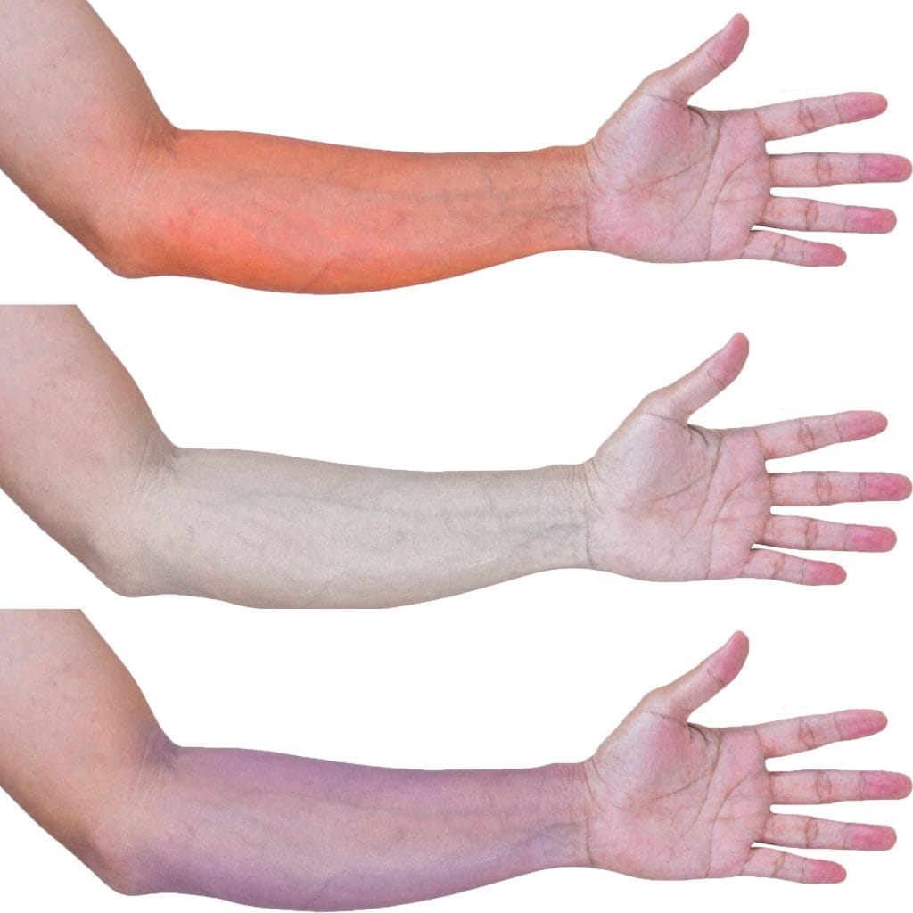 Color Changes and Temperature