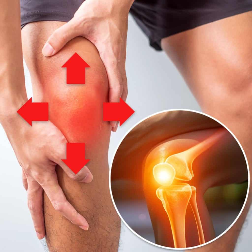 What is patellar tracking disorder