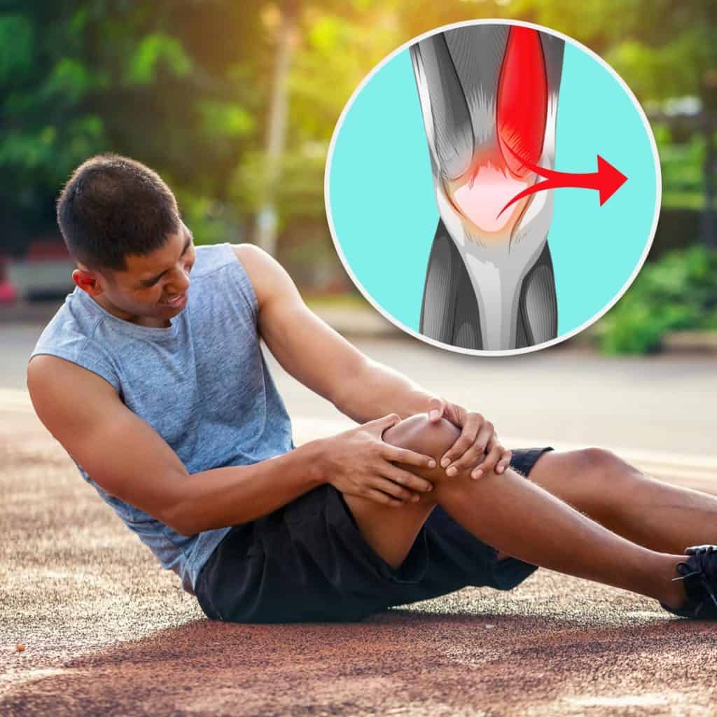 Muscle Imbalance or Weakness