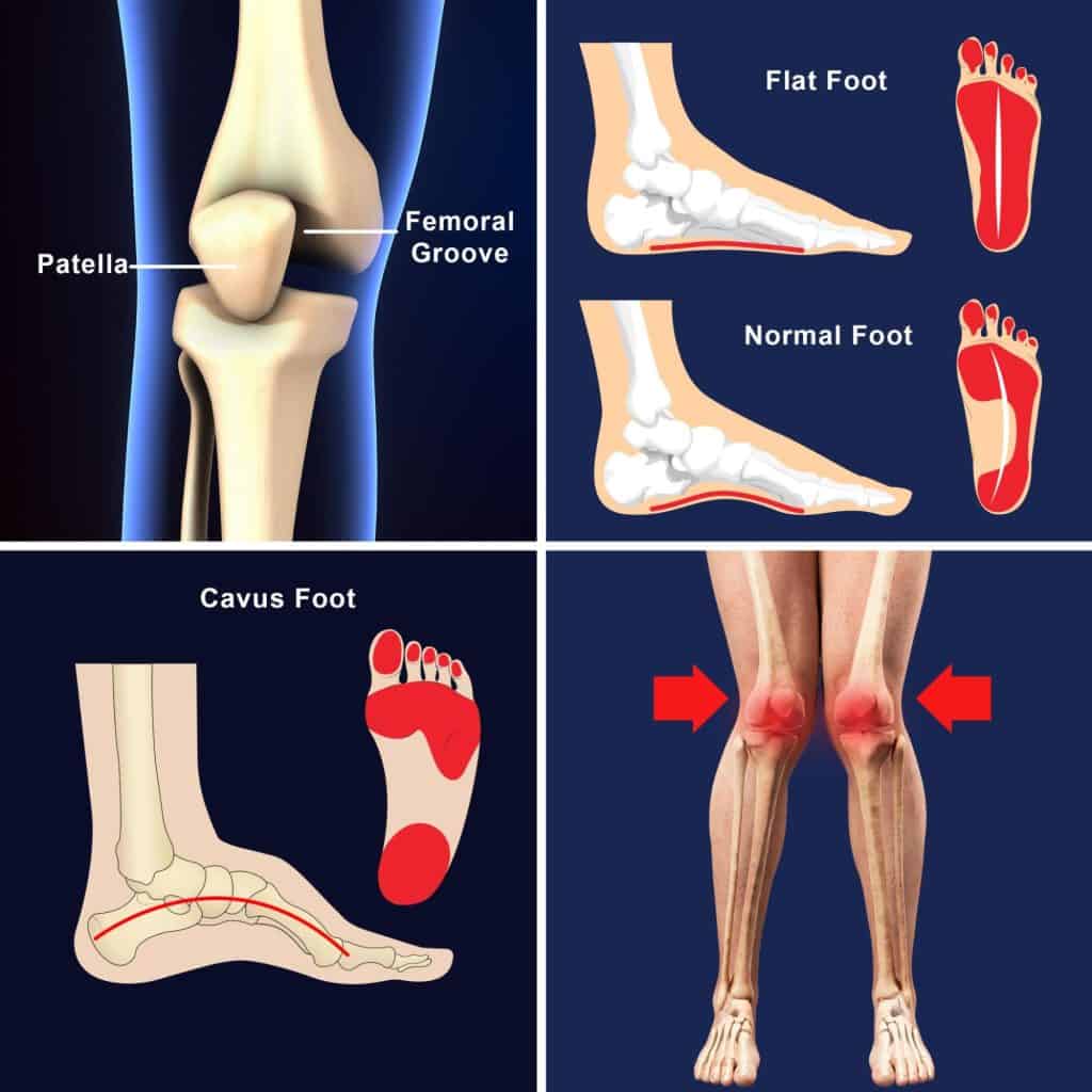 Knee Structure